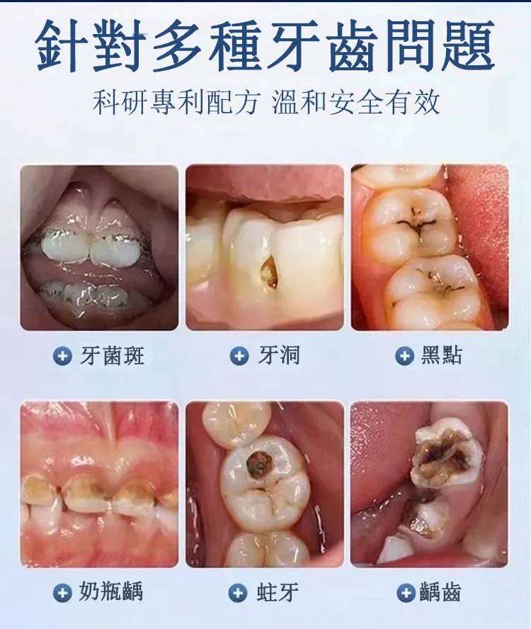 植物固齒散，固齒神方