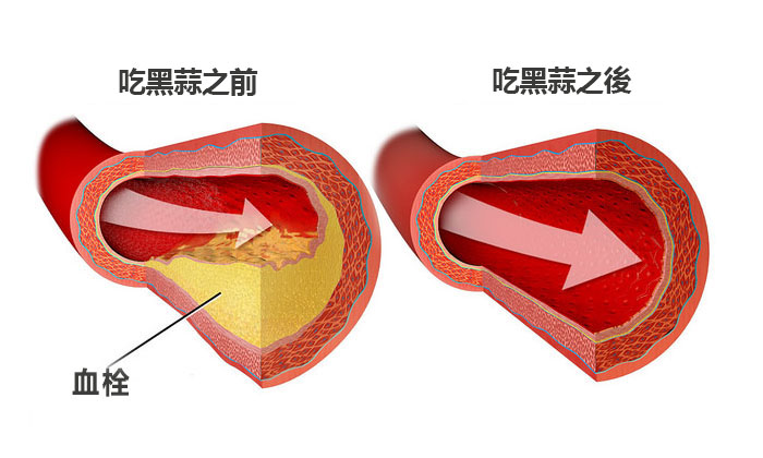 黑蒜油凝膠糖果