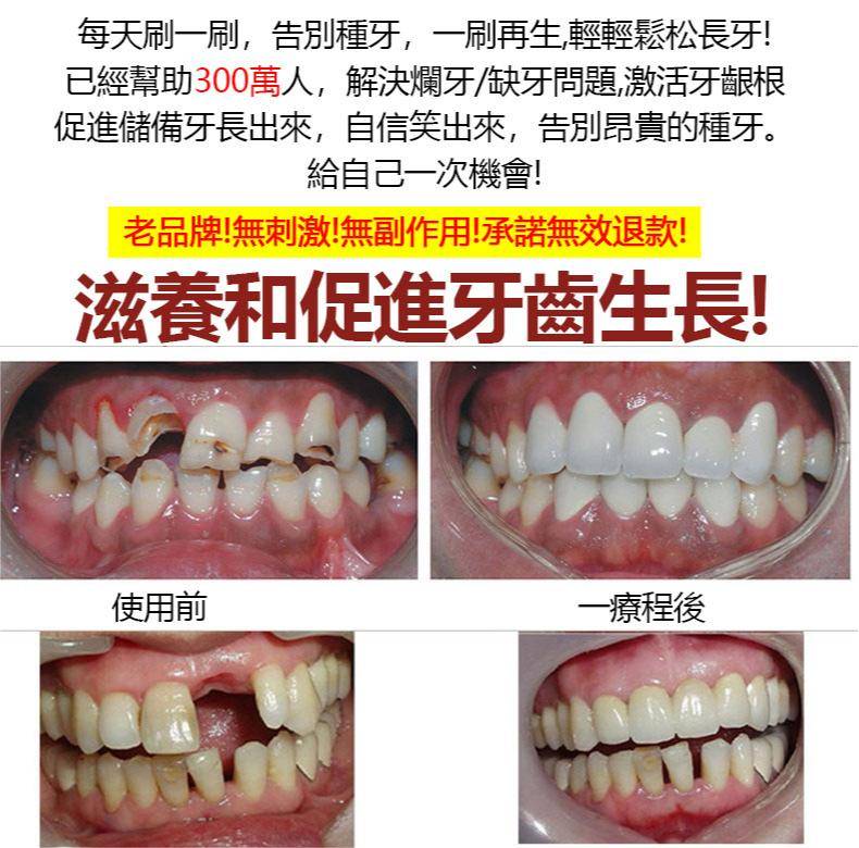 植物固齒散，固齒神方