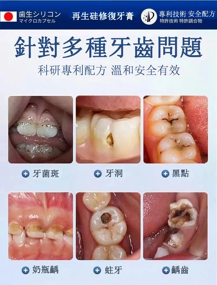 日本再生硅口腔抑菌牙膏