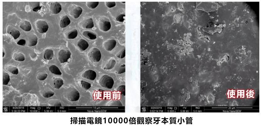 植物固齒散，固齒神方