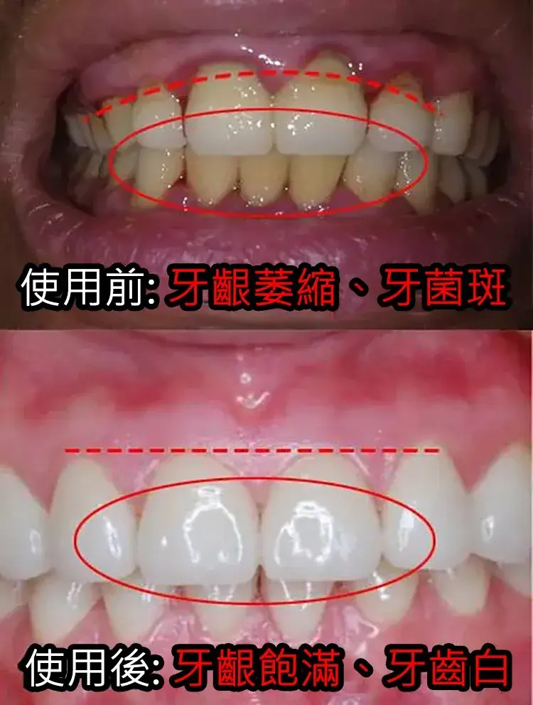 植物固齒散，固齒神方