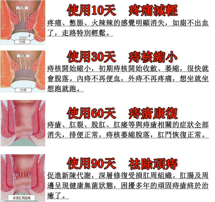 日本消立仁痔瘡膏