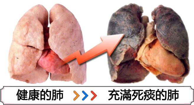 Barniontx香氛戒煙棒