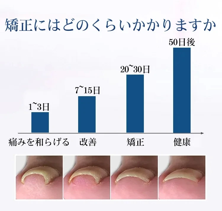 Jaysuing 抗甲溝緩解油