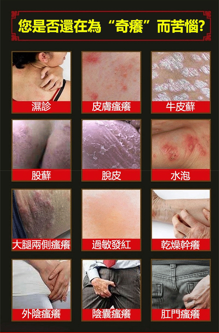 頑毒凈乳膏