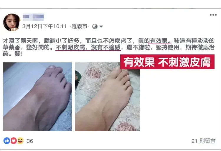 腱鞘型冷敷凝膠