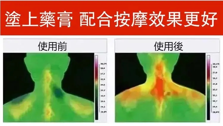 德國馬栗熱凝膏