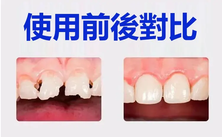 日本再生硅口腔抑菌牙膏