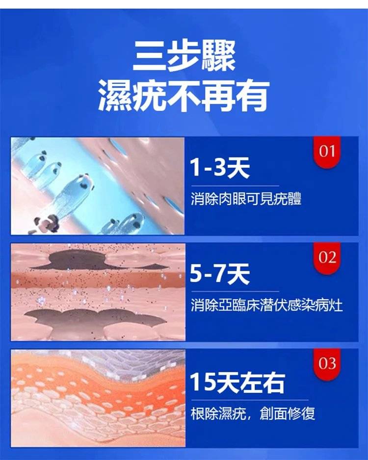 日本讃諾克克尤膏，治療病毒疣藥膏