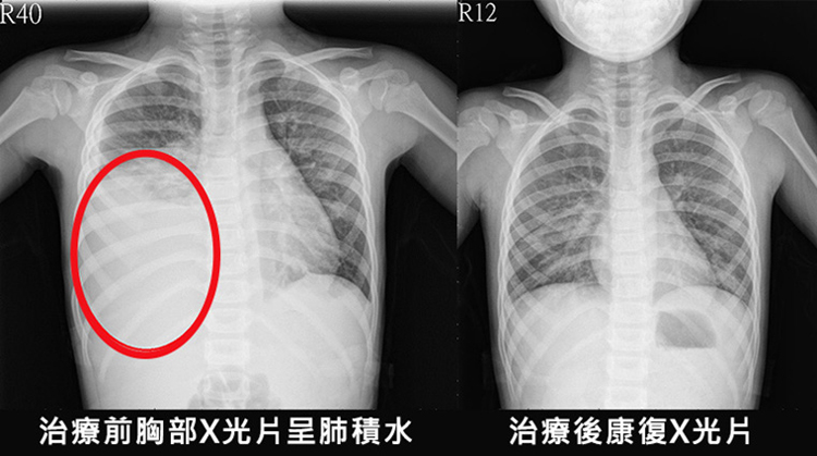 橘紅羅漢果清潤茶