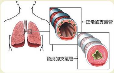 橘紅顆粒