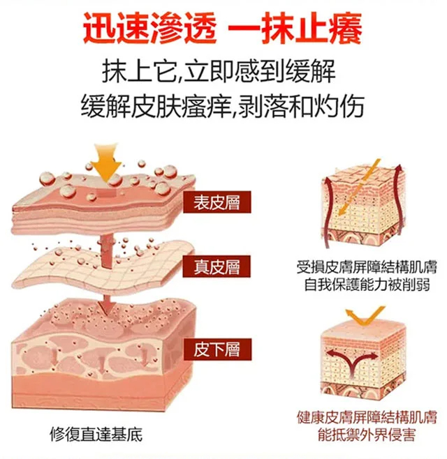 草本止癢去腳氣膏